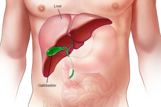 20 Signs That Your Liver Is Not Healthy 20 Signs That Your Liver Is Not Healthy